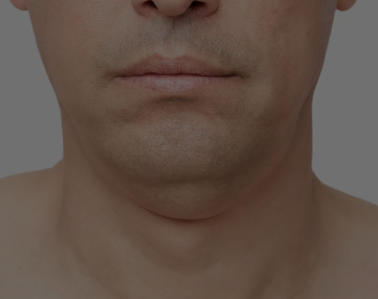 Can a Beard Hide a Double Chin? A Smart Grooming Guide